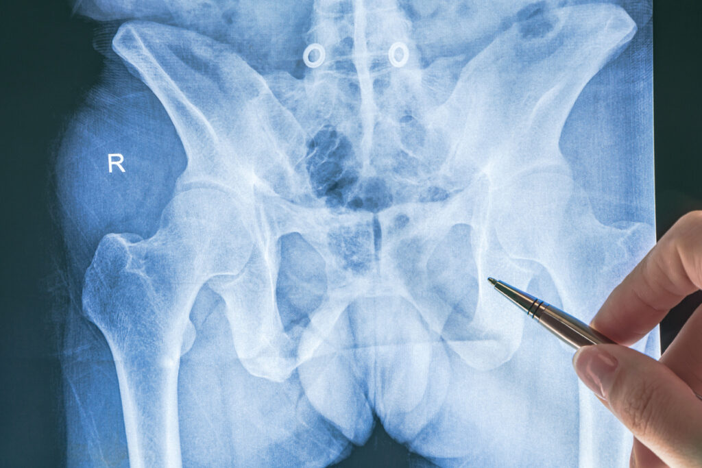 Diagnosing X-ray