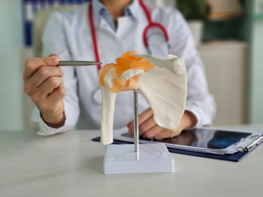 Doctor points to a hip joint model with orange-cartilage highlights on a stand for patient education